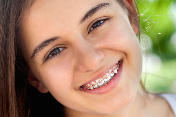 NONA-DIAMOND-DENTAL Orthodontics