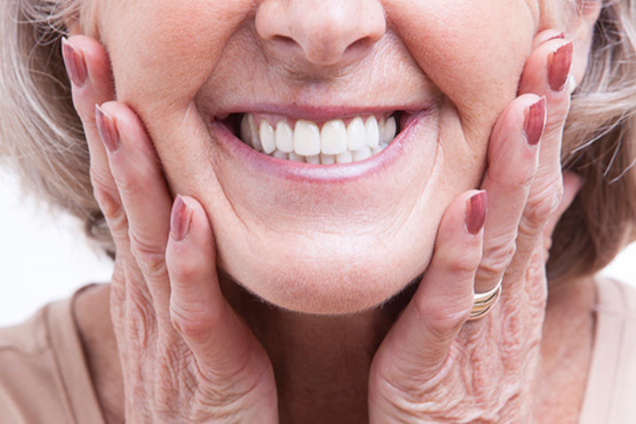 NONA-DIAMOND-DENTAL Implants